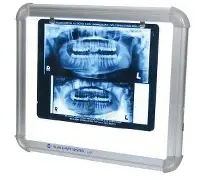 xray-viewer